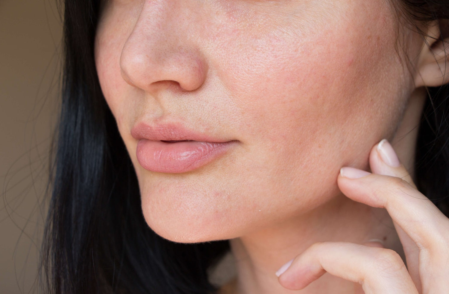 Hudpleje til rosacea